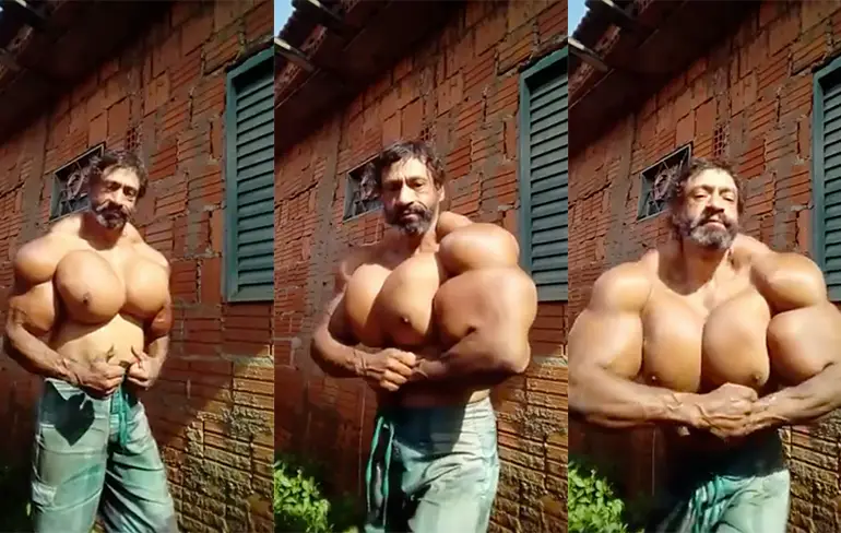 Nee joh Valdir Synthol, hoe jij eruit ziet is heel normaal!
