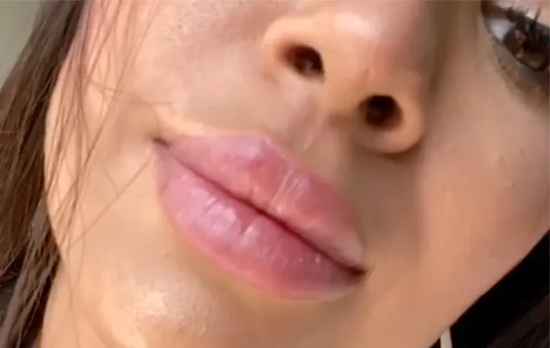 Nieuwe categorie op natuurfilm sites: Dames met mondkapjes