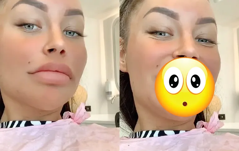 Ook Esmee Ipema naar Turkije om goedkope facings te nemen