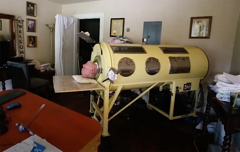 Polio patient Paul Alexander is afhankelijk van een ijzeren long