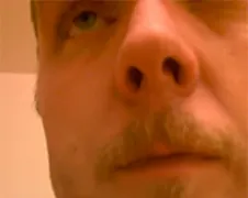 Pop jij anders zelf even dat bultje op je kaak...