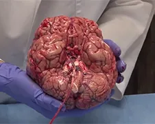 Professor laat stel hersenen van dichtbij zien