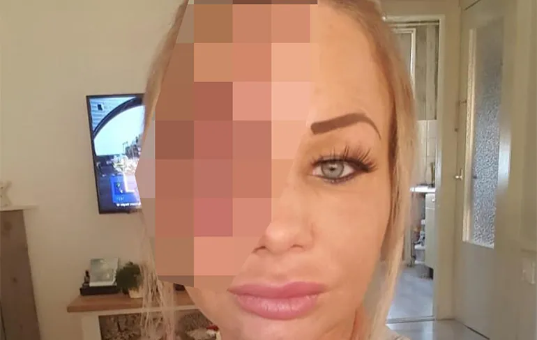 Samantha de Jong aka Barbie revalideert thuis en deelt schokkende foto's