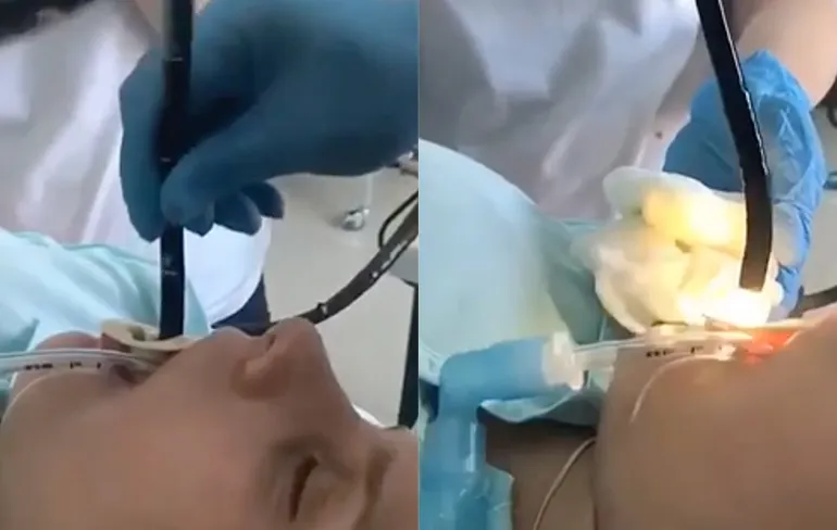 Slang in Dagestan kruipt via mond slapend meisje in maag