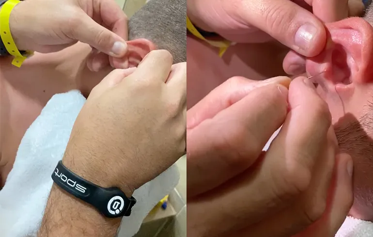 Sow, dat is een aardig propje oorsmeer