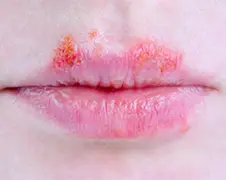 Sporen cocaïne en herpes op bibliotheekboeken Antwerpen