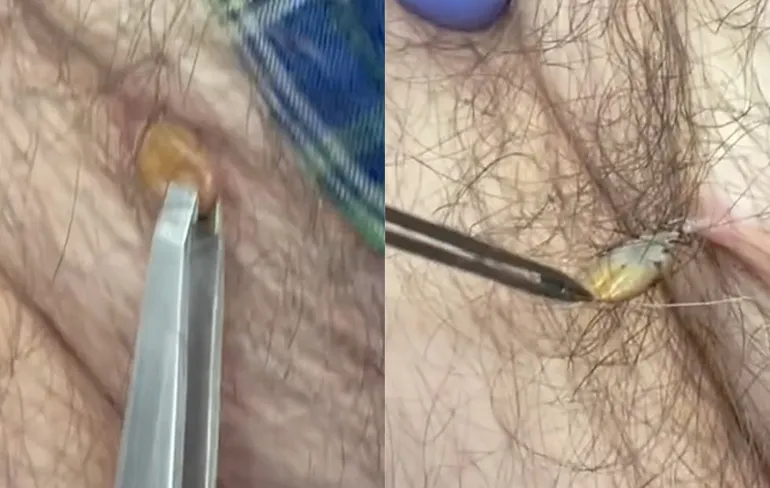 Steelwratje blijkt een grote teek te zijn