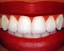 Tandarts doet nare ontdekking na trekken tanden