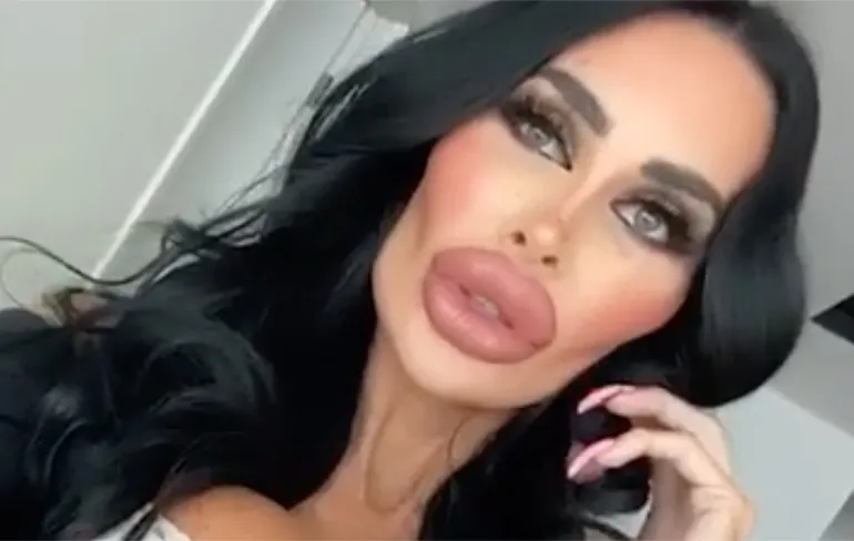 Tara Jayne McConachy uit Australie is verslaafd aan plastische chirurgie