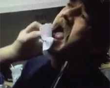 Tokkie uit Assen laat tand trekken met grote tang!