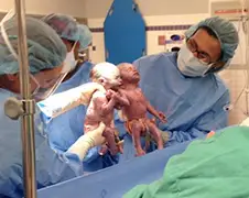 Tweeling Jenna en Jillian kwamen hand in hand ter wereld