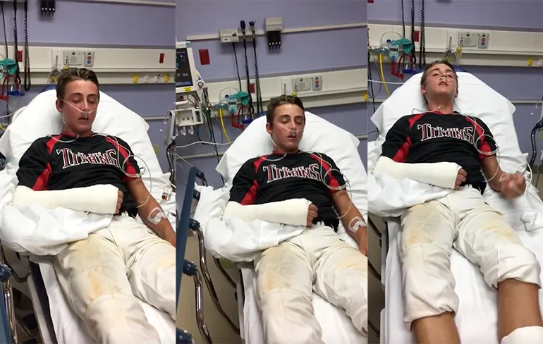 Ventje raaskalt er lekker op los door verdoving operatie gebroken arm