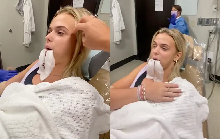 Verdoving verwijderen verstandskiezen zorgt ervoor dat meisje volkslied gaat zingen