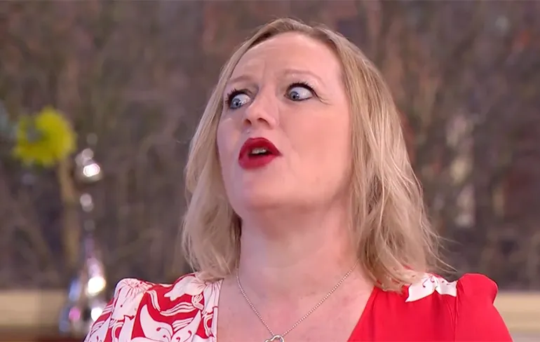 Vrouw heeft een nieuwe neus die vastzit met magneetjes