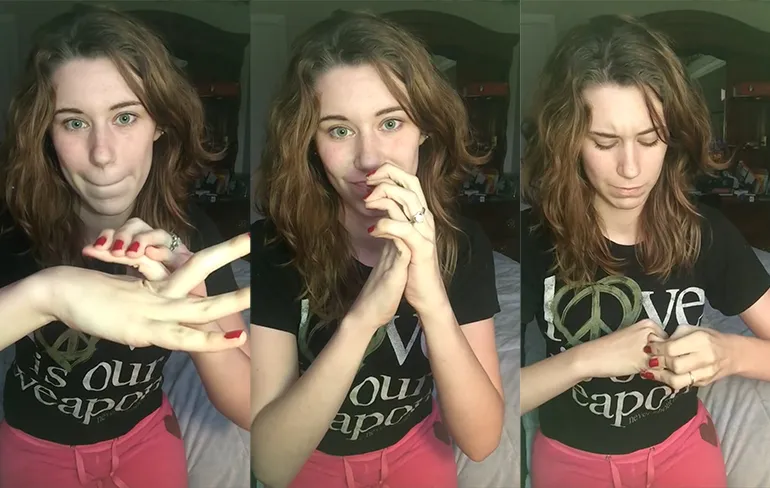 Vrouw heeft Hypermobiliteitssyndroom van Syndroom van Ehlers-Danlos