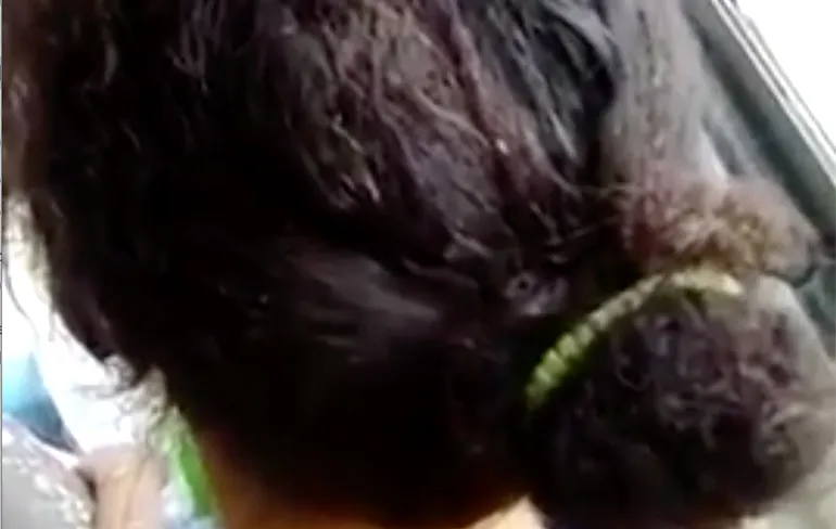 Vrouw in bus heeft een luizen uitbraak op haar hoofd