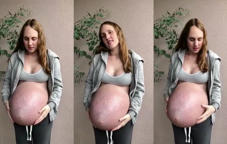 Vrouw is 33 weken zwanger van drieling en laat buik zien