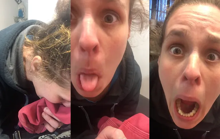 Vrouw laat haar ster tatoeëren en is nogal onder invloed van heel veel