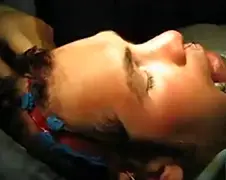 Weleens een gezicht zonder gezichtsspieren gezien?