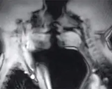 Zo ziet leven eruit door een MRI-scanner
