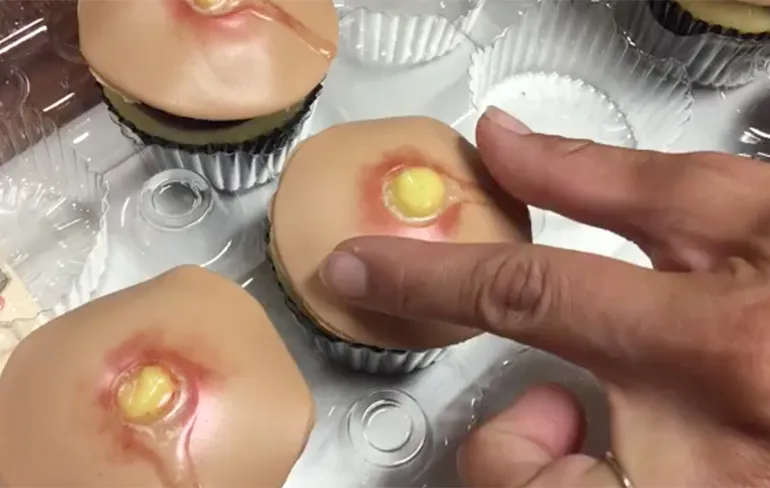 Zou jij deze Dr. Pimple Popper Cupcakes lusten?