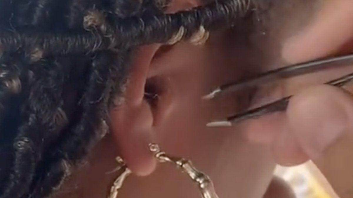 Dame heeft een baby krab in haar oor gekregen tijdens vakantie in Puerto Rico