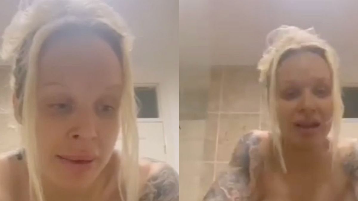 Video van verdrietige vrouw voordat een van haar borsten kapot ging