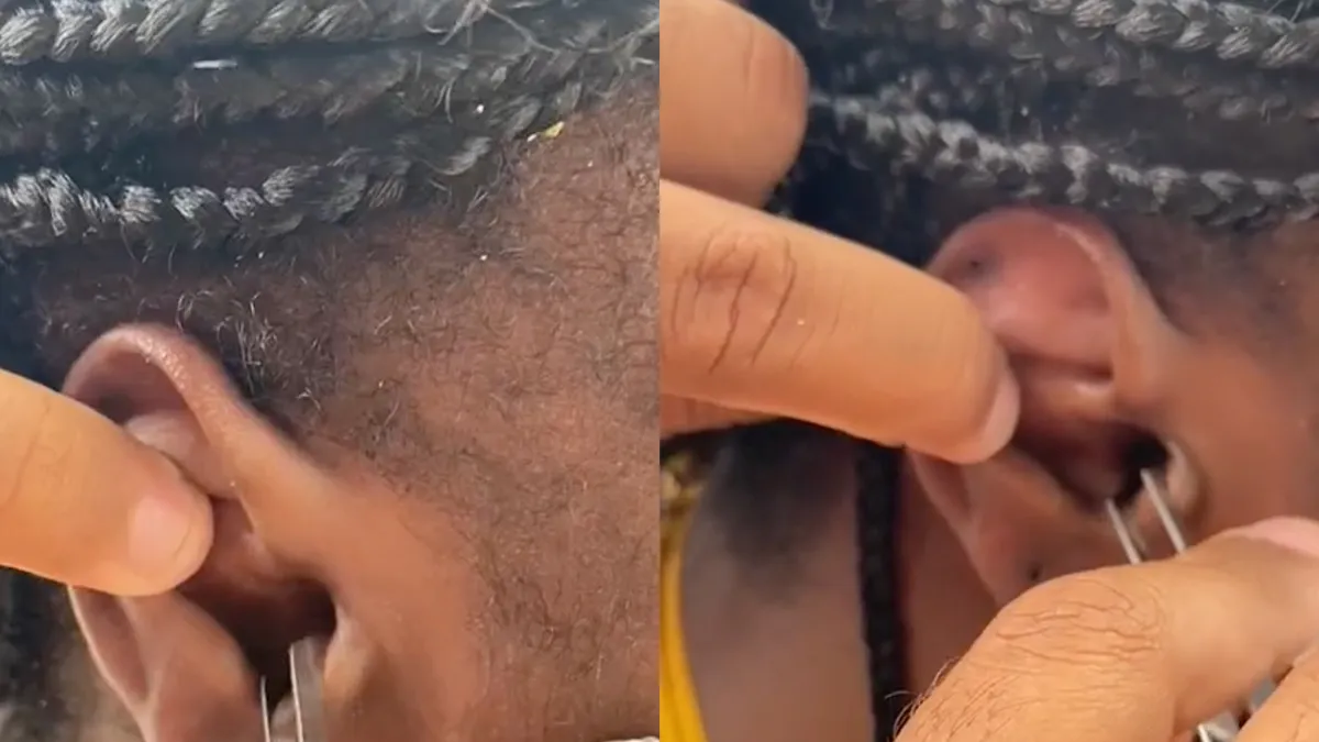 Vrouw heeft na snorkelen krab als huisdier in haar oor