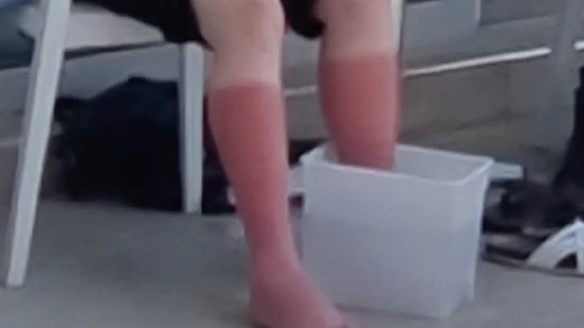 Waarom je dus ook een beetje op moet passen met de zon vandaag