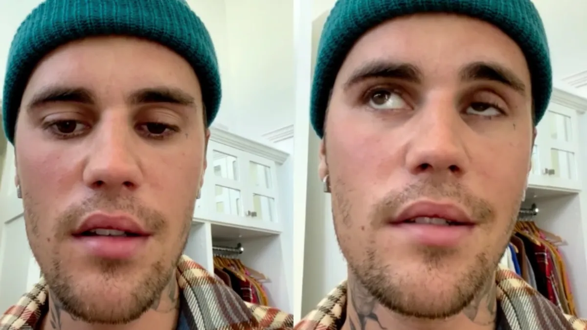 Halve gezicht van Justin Bieber verlamd