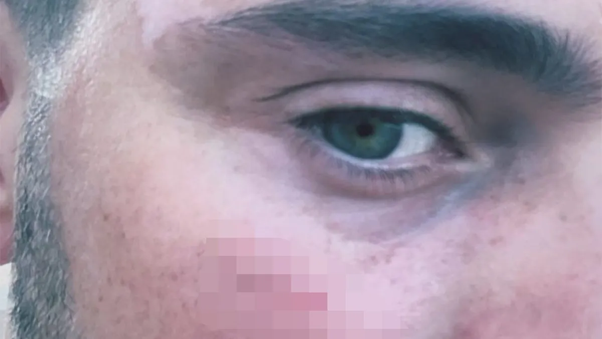 Martin Garrix hard geraakt door een fles die gegooid werd