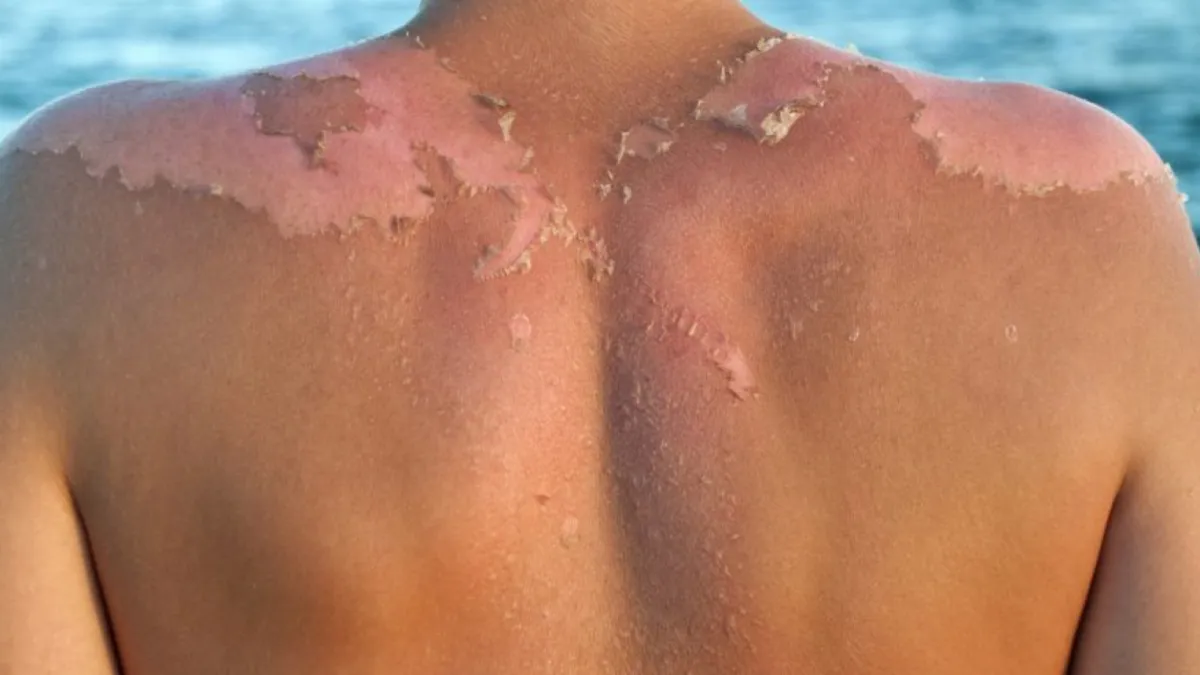 Vakantiegangers opgelet, de politie heeft je hulp nodig