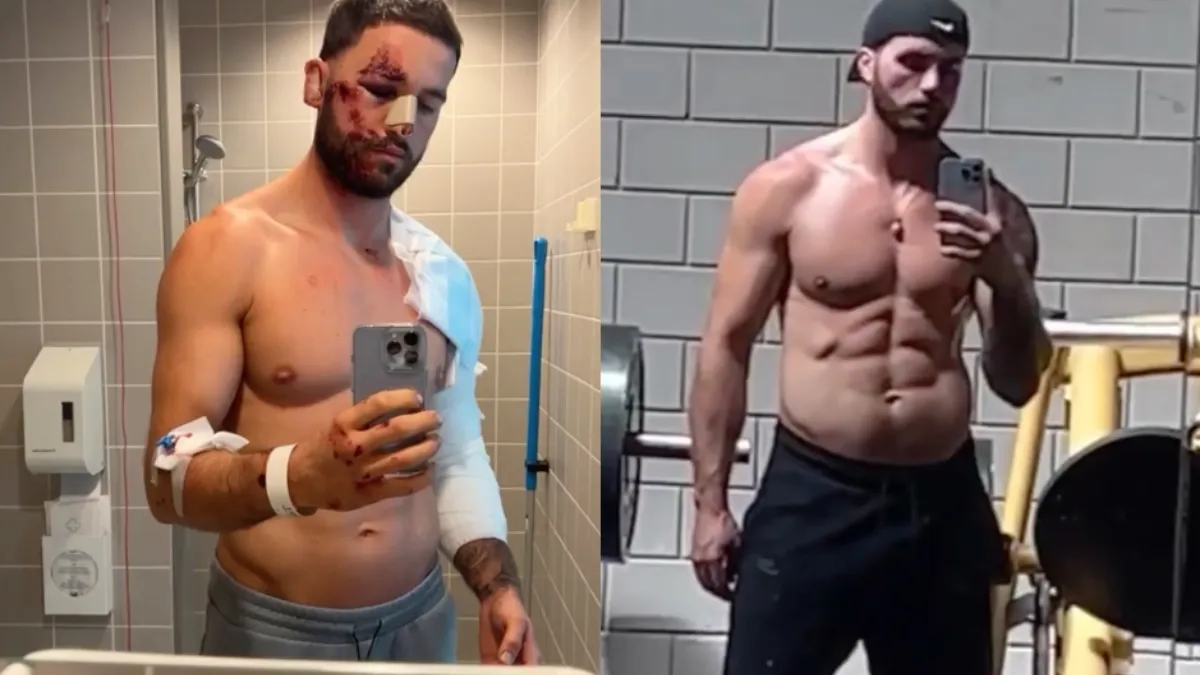 Donny Roelvink lijkt weer redelijk het mannetje na overreden te zijn door Hummer