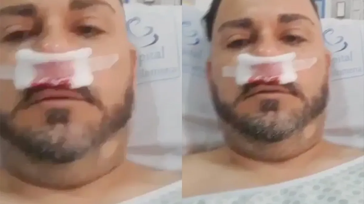 Zo, leg jij eens uit hoe je aan die aparte blessure aan je gezicht komt?