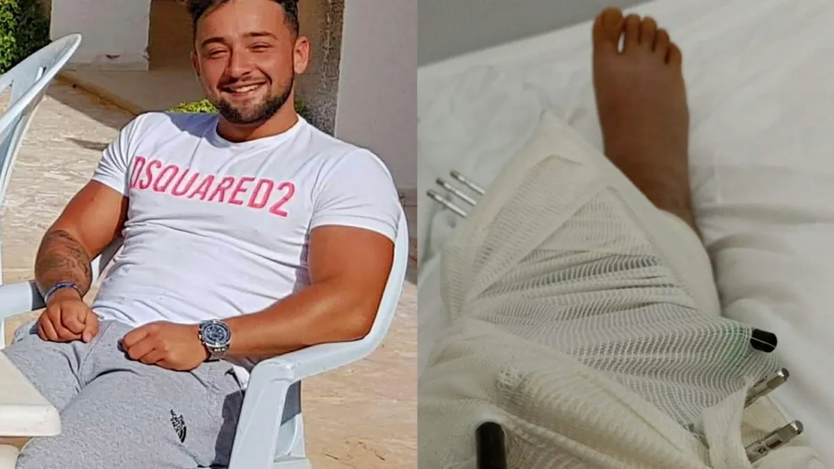 Jesse houdt verbrijzeld been over na sussen vechtpartij in Chersonissos