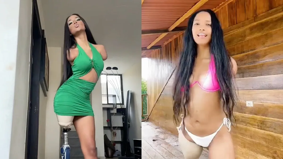 Victoria heeft maar één been, maar is een plaatje om te zien