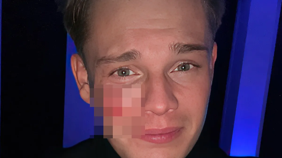 Dennis Schouten in zijn gezicht gestoken tijdens uitgaan