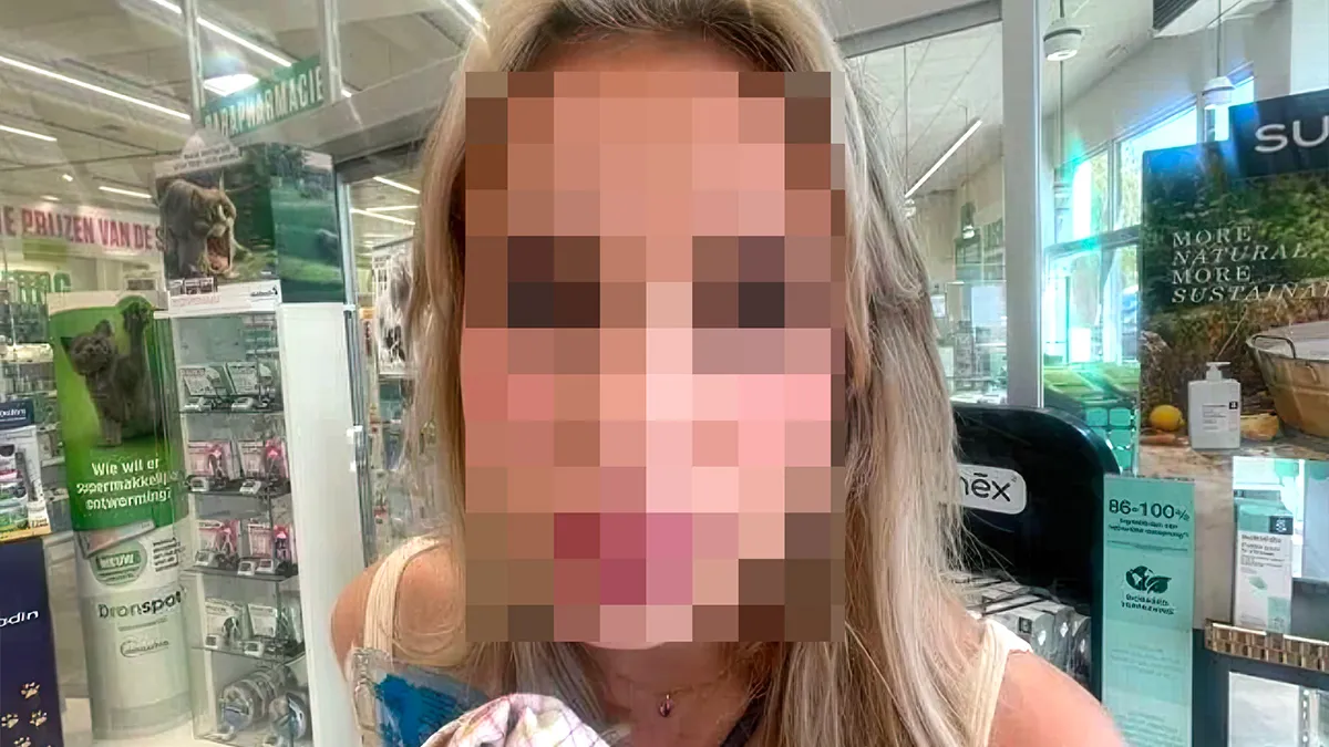 Meid krijg extreem allergische reactie op lipfillers en heel veel spijt