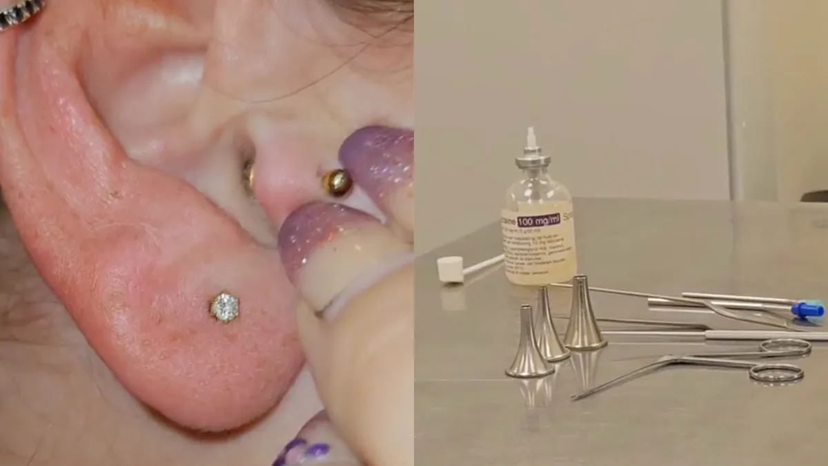 Nachtmerrie Nederlandse vrouw komt uit: Zilvervisje in oor