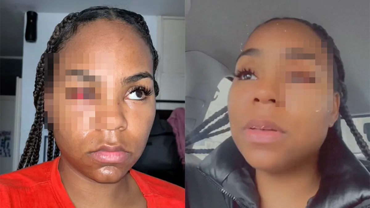 Vrouw na stappen in elkaar geslagen door man in Rotterdam