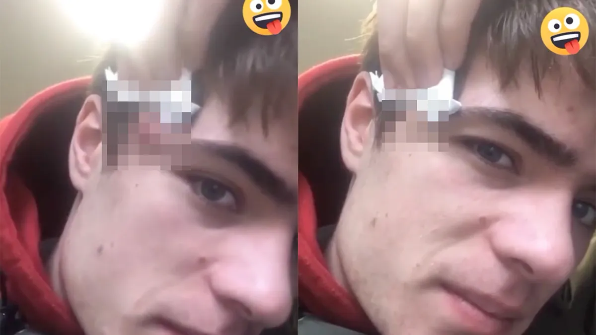 thumb vk dit puistje is niet voor mensen met een zwakke maag