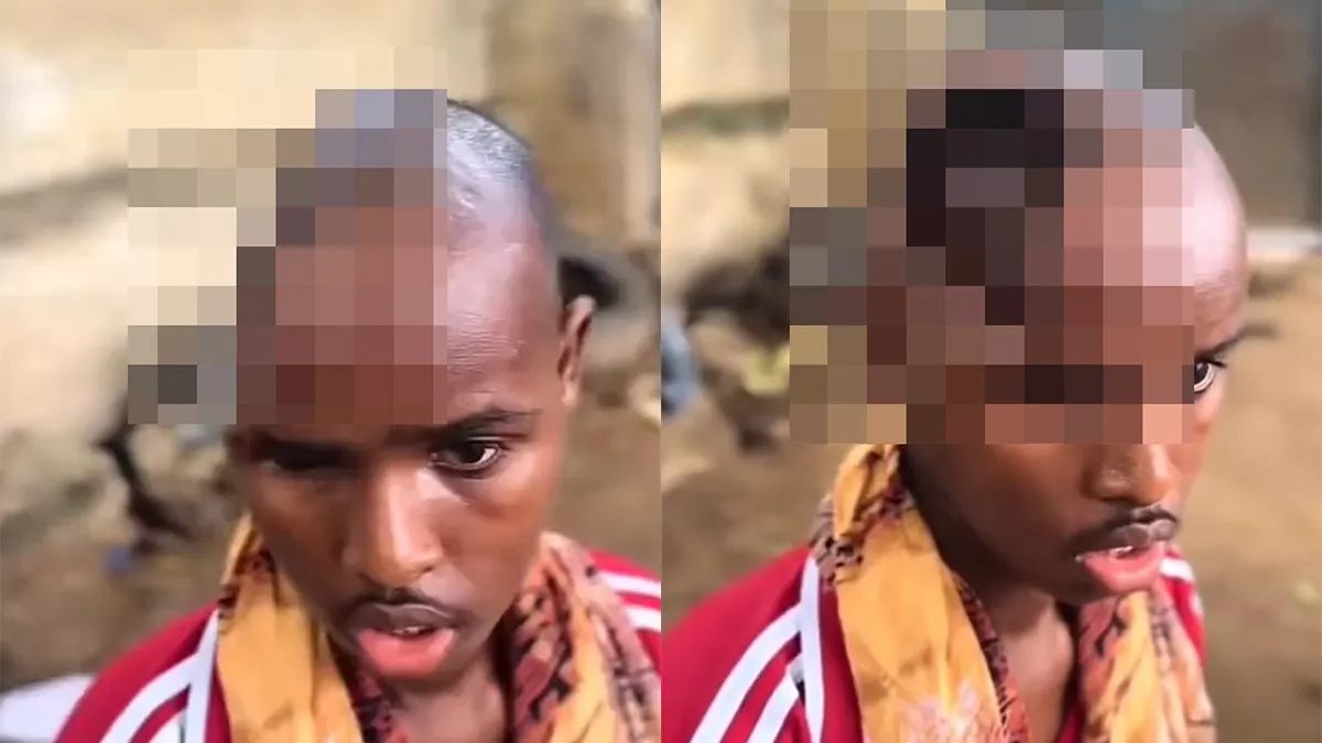 thumb vk een unicum geboren zonder hersens