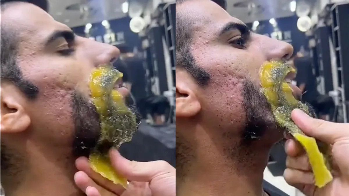 thumb vk pfff pijnlijk beter trek je een scheermes over je gezicht