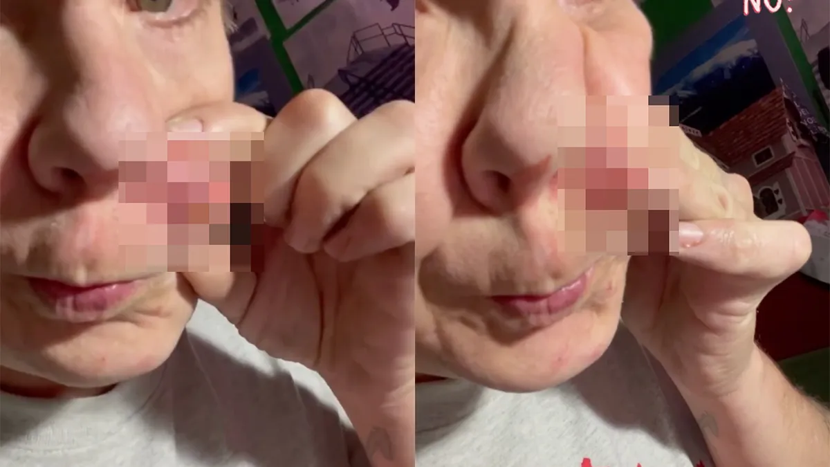 thumb vk pukkeltje poppen is geen gezicht