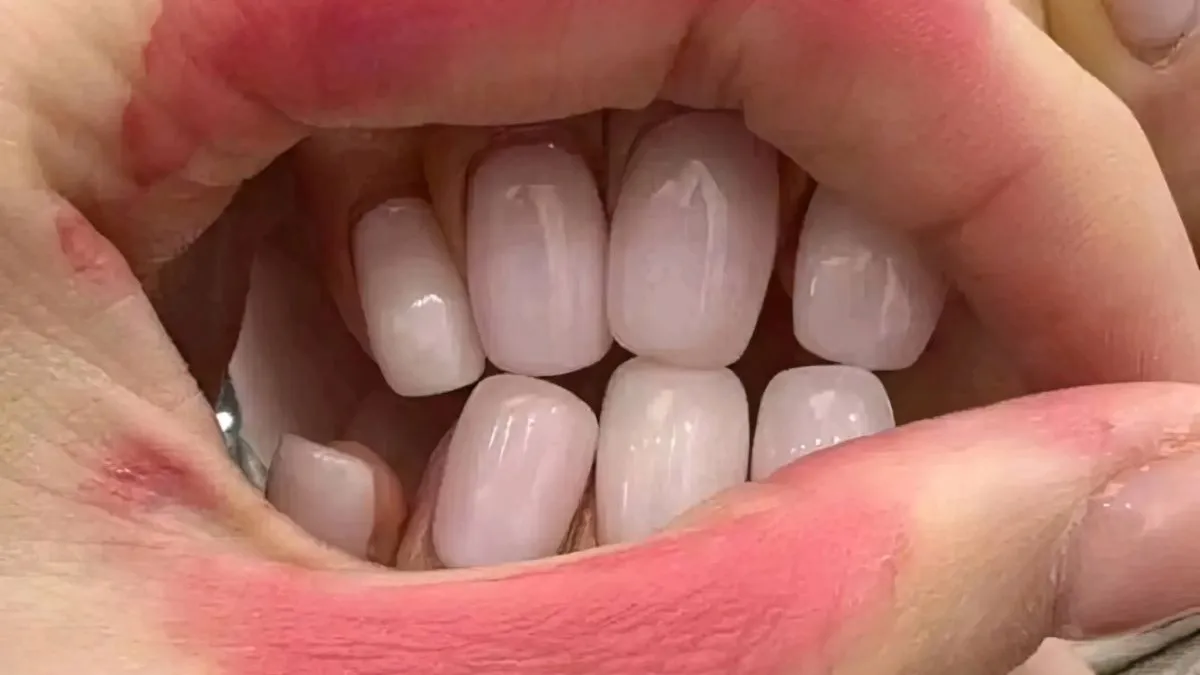 thumb vk gewoon fotos 1856