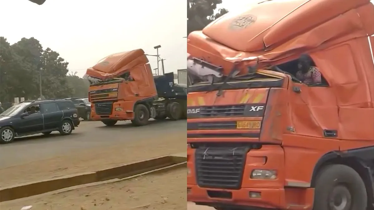 thumb vk in togo doen ze niet moeilijk over een deukje meer of minder