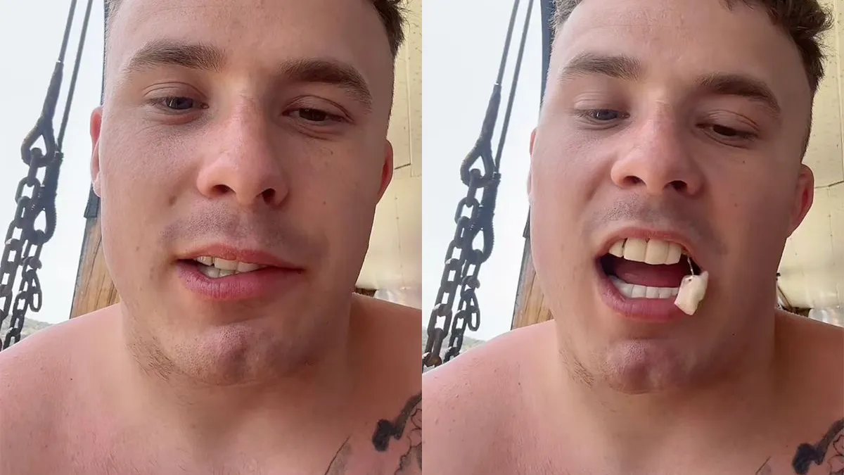 thumb vk gast grapt met zijn tijdelijke turkse tandjes