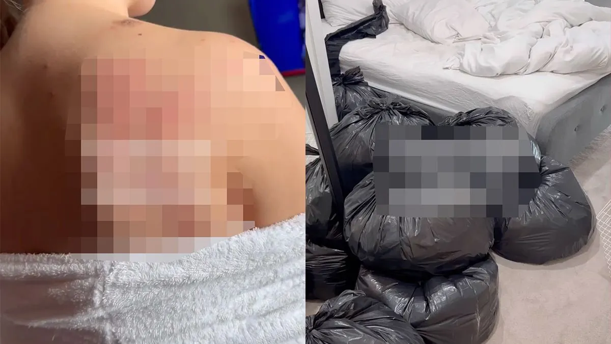 thumb vk moet je je hele huis laten reinigen omdat hotel in amsterdam bedwantsen heeft