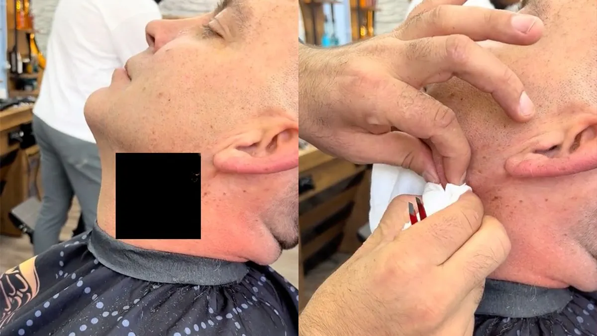 thumb vk kapper in venlo biedt extra service aan knijpt bultje met verse mayo uit