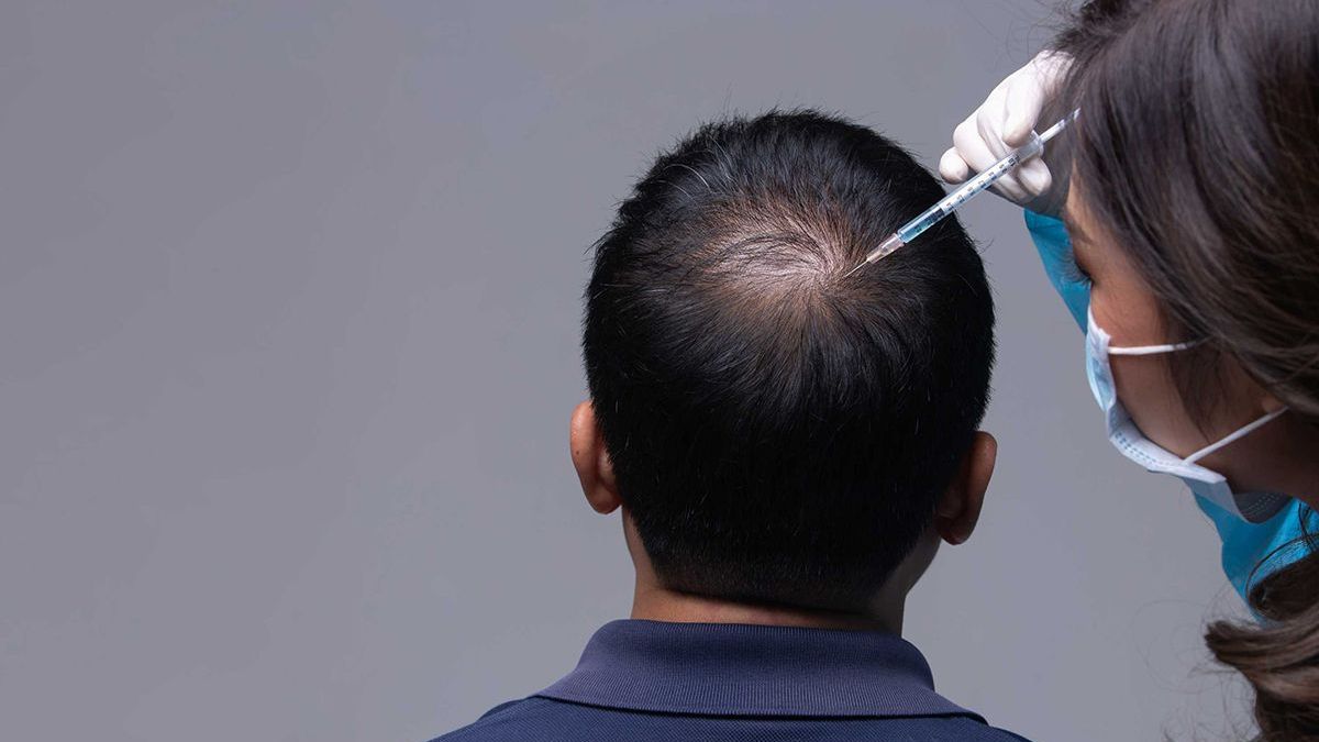 Wat kun je verwachten na een haartransplantatie?